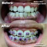 {"remix_data":[],"remix_entry_point":"challenges","source_tags":[],"origin":"unknown","total_draw_time":0,"total_draw_actions":0,"layers_used":0,"brushes_used":0,"photos_added":0,"total_editor_actions":{},"tools_used":{},"is_sticker":false,"edited_since_last_sticker_save":false,"containsFTESticker":false}