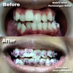 {"remix_data":[],"remix_entry_point":"challenges","source_tags":[],"origin":"unknown","total_draw_time":0,"total_draw_actions":0,"layers_used":0,"brushes_used":0,"photos_added":0,"total_editor_actions":{},"tools_used":{},"is_sticker":false,"edited_since_last_sticker_save":false,"containsFTESticker":false}