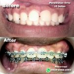 {"remix_data":[],"remix_entry_point":"challenges","source_tags":[],"origin":"unknown","total_draw_time":0,"total_draw_actions":0,"layers_used":0,"brushes_used":0,"photos_added":0,"total_editor_actions":{},"tools_used":{},"is_sticker":false,"edited_since_last_sticker_save":false,"containsFTESticker":false}