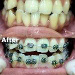 {"remix_data":[],"remix_entry_point":"challenges","source_tags":[],"origin":"unknown","total_draw_time":0,"total_draw_actions":0,"layers_used":0,"brushes_used":0,"photos_added":0,"total_editor_actions":{},"tools_used":{},"is_sticker":false,"edited_since_last_sticker_save":false,"containsFTESticker":false}