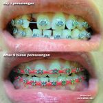 {"remix_data":[],"remix_entry_point":"challenges","source_tags":[],"origin":"unknown","total_draw_time":0,"total_draw_actions":0,"layers_used":0,"brushes_used":0,"photos_added":0,"total_editor_actions":{},"tools_used":{},"is_sticker":false,"edited_since_last_sticker_save":false,"containsFTESticker":false}