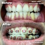 {"remix_data":[],"remix_entry_point":"challenges","source_tags":[],"origin":"unknown","total_draw_time":0,"total_draw_actions":0,"layers_used":0,"brushes_used":0,"photos_added":0,"total_editor_actions":{},"tools_used":{},"is_sticker":false,"edited_since_last_sticker_save":false,"containsFTESticker":false}