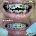 {"remix_data":[],"remix_entry_point":"challenges","source_tags":[],"origin":"unknown","total_draw_time":0,"total_draw_actions":0,"layers_used":0,"brushes_used":0,"photos_added":0,"total_editor_actions":{},"tools_used":{},"is_sticker":false,"edited_since_last_sticker_save":false,"containsFTESticker":false}