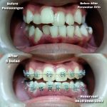 {"remix_data":[],"remix_entry_point":"challenges","source_tags":[],"origin":"unknown","total_draw_time":0,"total_draw_actions":0,"layers_used":0,"brushes_used":0,"photos_added":0,"total_editor_actions":{},"tools_used":{},"is_sticker":false,"edited_since_last_sticker_save":false,"containsFTESticker":false}