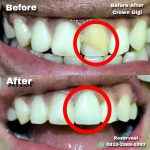 {"remix_data":[],"remix_entry_point":"challenges","source_tags":[],"origin":"unknown","total_draw_time":0,"total_draw_actions":0,"layers_used":0,"brushes_used":0,"photos_added":0,"total_editor_actions":{},"tools_used":{},"is_sticker":false,"edited_since_last_sticker_save":false,"containsFTESticker":false}