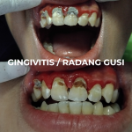 Salinan dari Salinan dari Salinan dari Salinan dari Salinan dari Salinan da_20250518_194315_0000