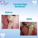 WhatsApp Image 2023-06-20 at 12.35.31 (1)