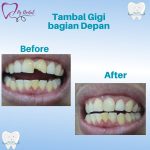 WhatsApp Image 2023-06-20 at 12.35.32 (1)