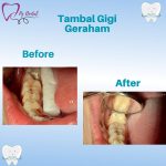 WhatsApp Image 2023-06-20 at 12.35.32