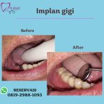 WhatsApp Image 2023-06-20 at 12.47.34