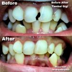 {"remix_data":[],"remix_entry_point":"challenges","source_tags":[],"origin":"unknown","total_draw_time":0,"total_draw_actions":0,"layers_used":0,"brushes_used":0,"photos_added":0,"total_editor_actions":{},"tools_used":{},"is_sticker":false,"edited_since_last_sticker_save":false,"containsFTESticker":false}